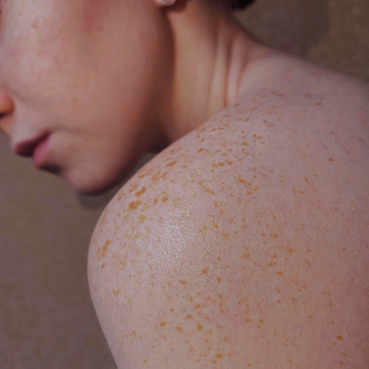 Close up of a freckled shoulder.