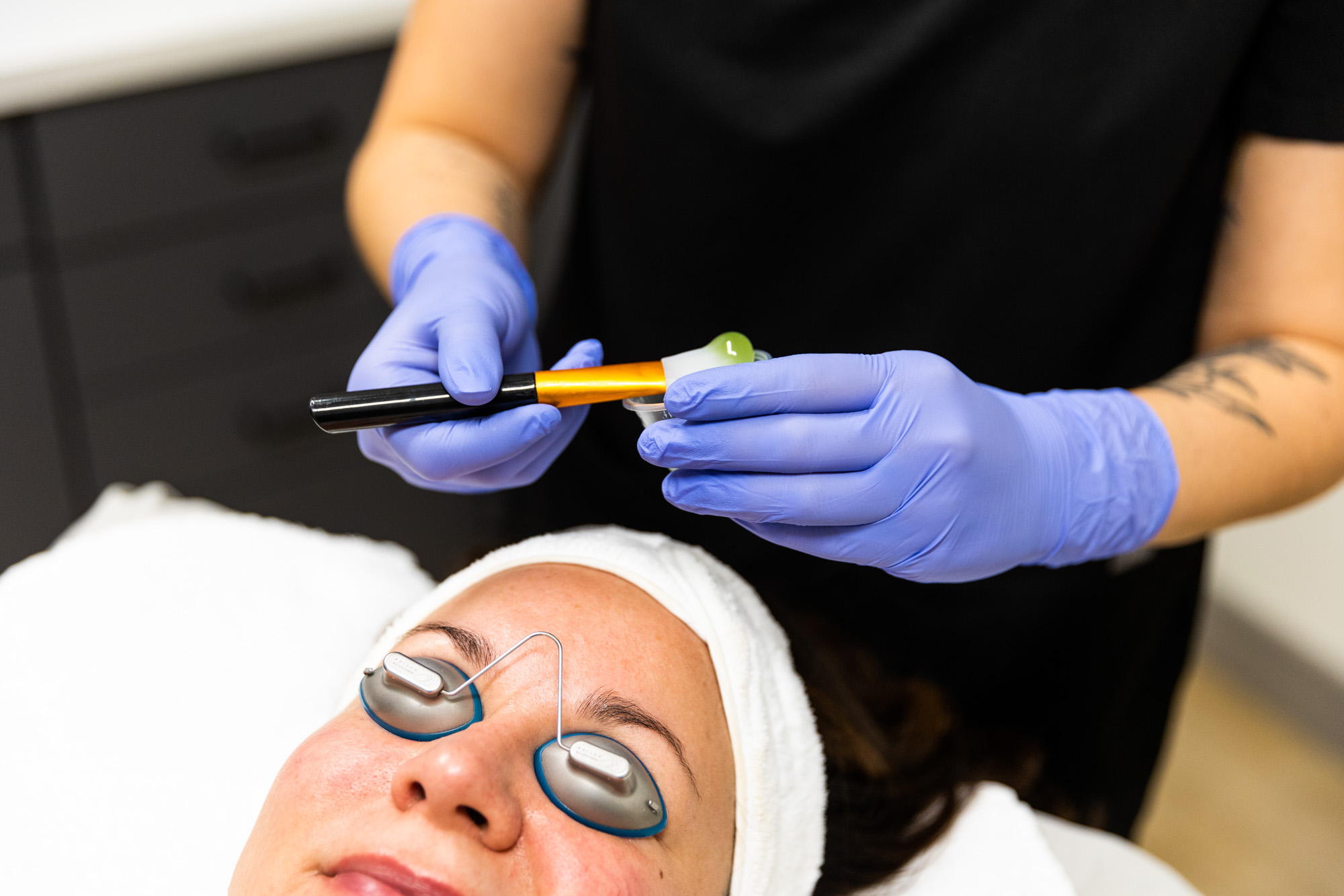 A Kansas City Skin and Cancer Center employee dips the applicator tool back into the small cup of facial gel above a female client's forehead.