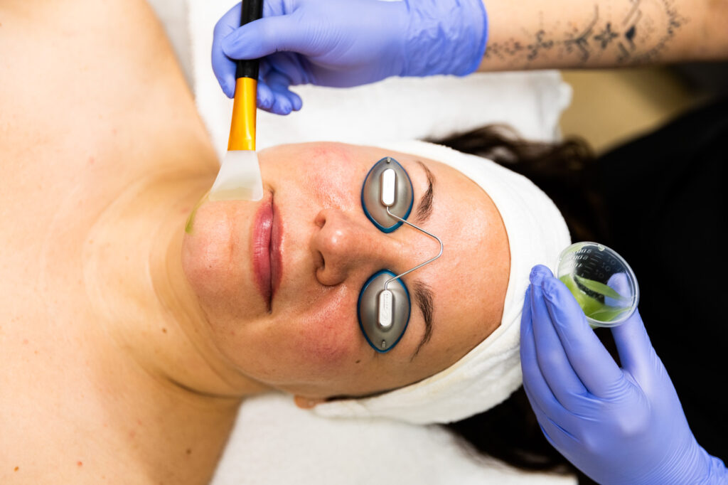 A medical professional applies a green facial gel onto a patient's chin. The patient is lying down and wearing protective eye coverings.