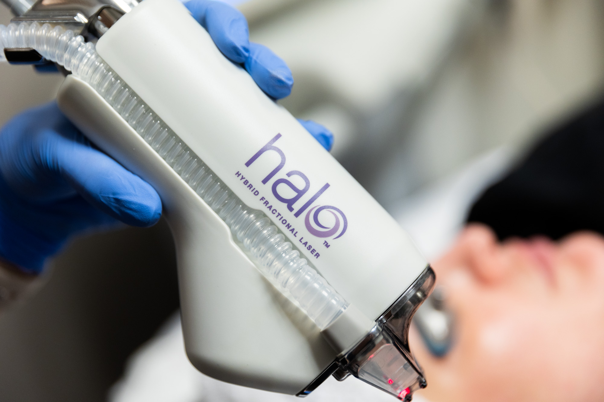 Close up image of the HALO handheld application tool. A medical provider can easily hold it in one hand. There is a tube that runs along the side of the applicator.