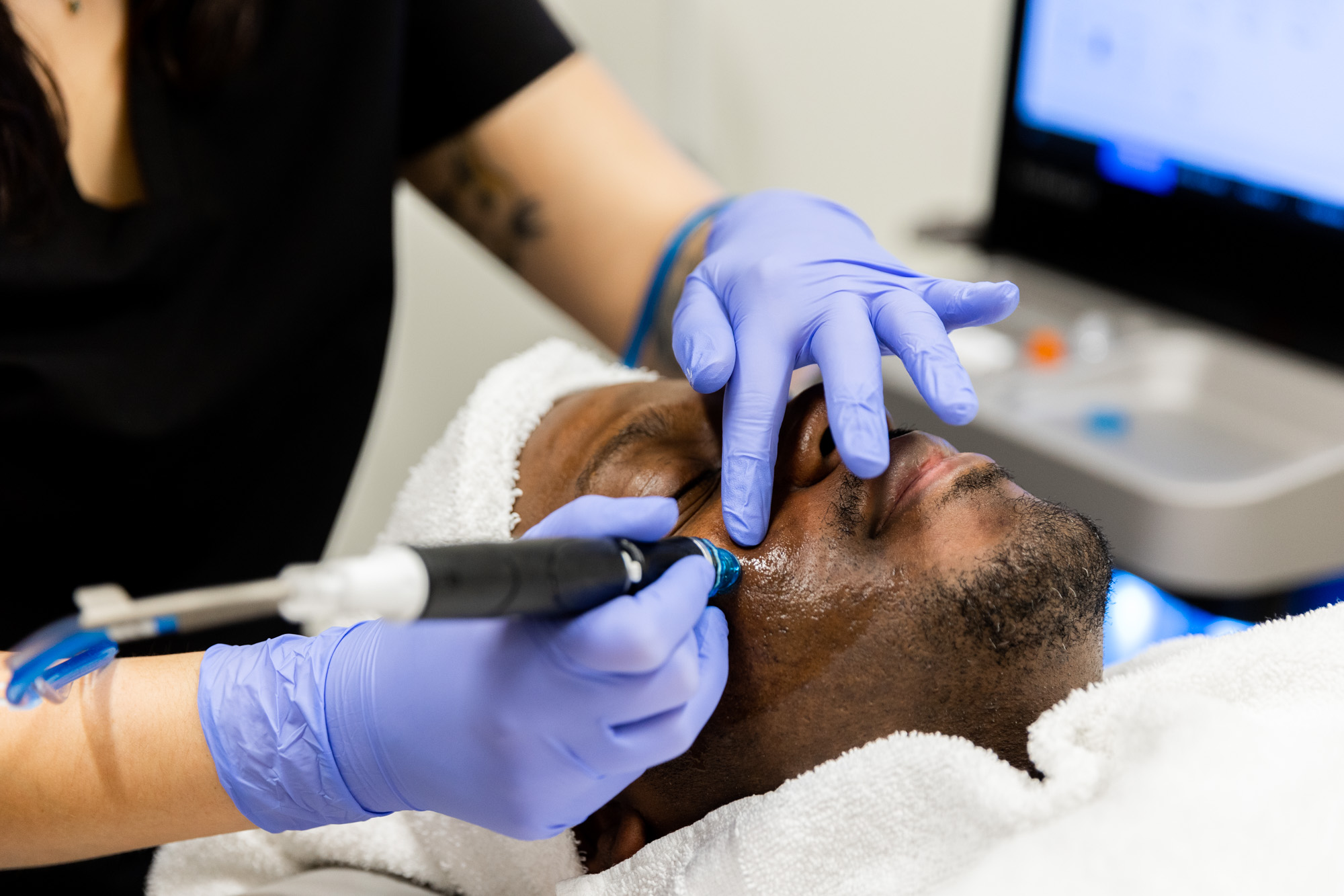A male client receives a Hydrafacial from a Kansas City Skin and Cancer Center medical provider. The medical provider is wearing gloves and using one hand to hold the hydrafacial applicator and the other hand to guide the tool along the client's cheek.