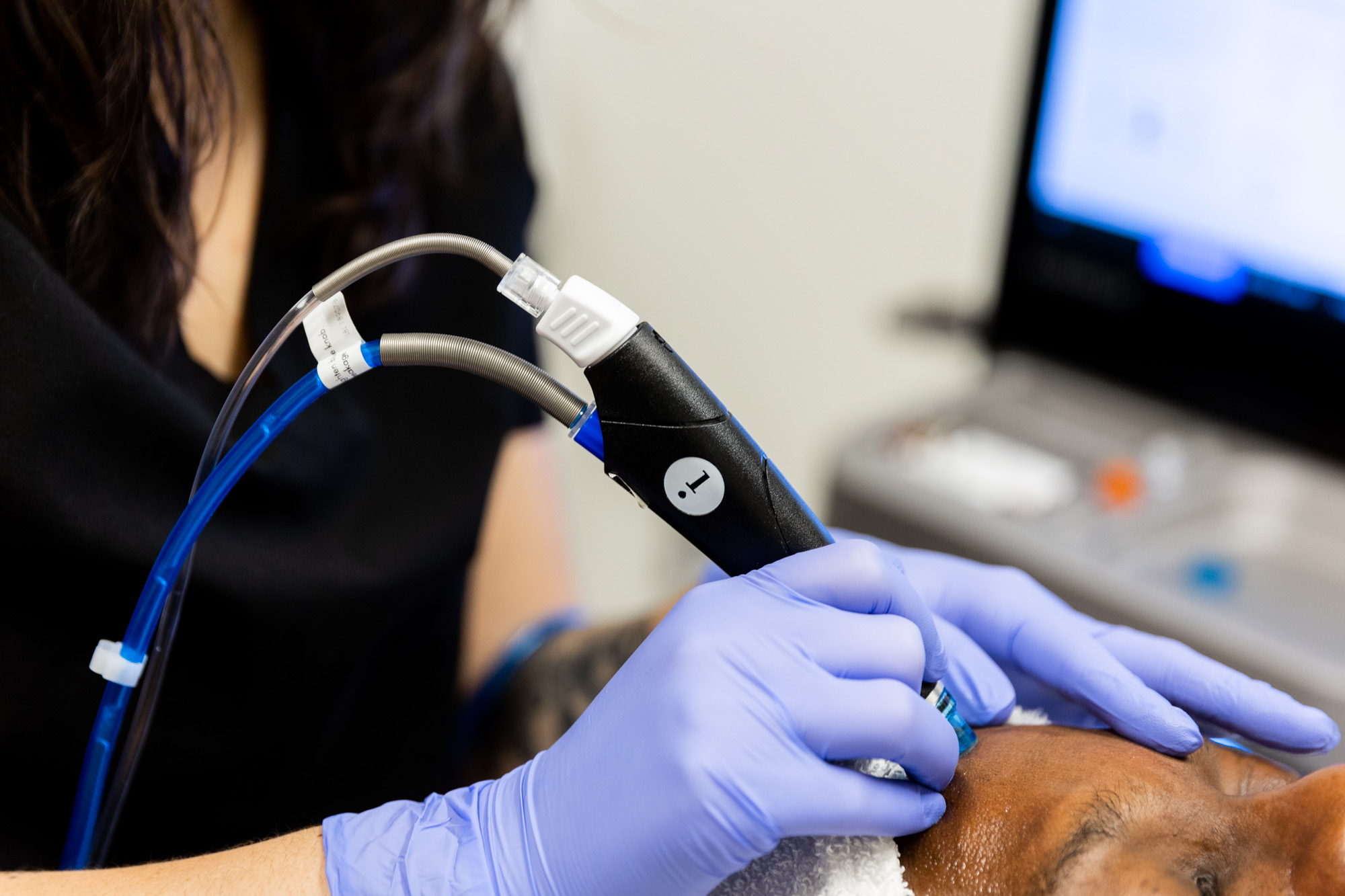 Close up of a client receiving a hydrafacial. In the image is the hydrafacial handheld application device and the hands of the medical professional administering the treatment, as well as the client's forehead.