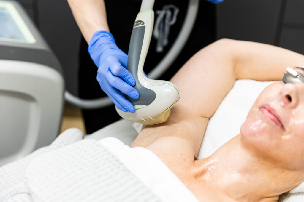 A patient, relaxing on her back and wearing protective eyewear, receives her laser hair removal near Overland Park. Her provider, wearing surgical gloves, guides the handheld laser device over her armpit.