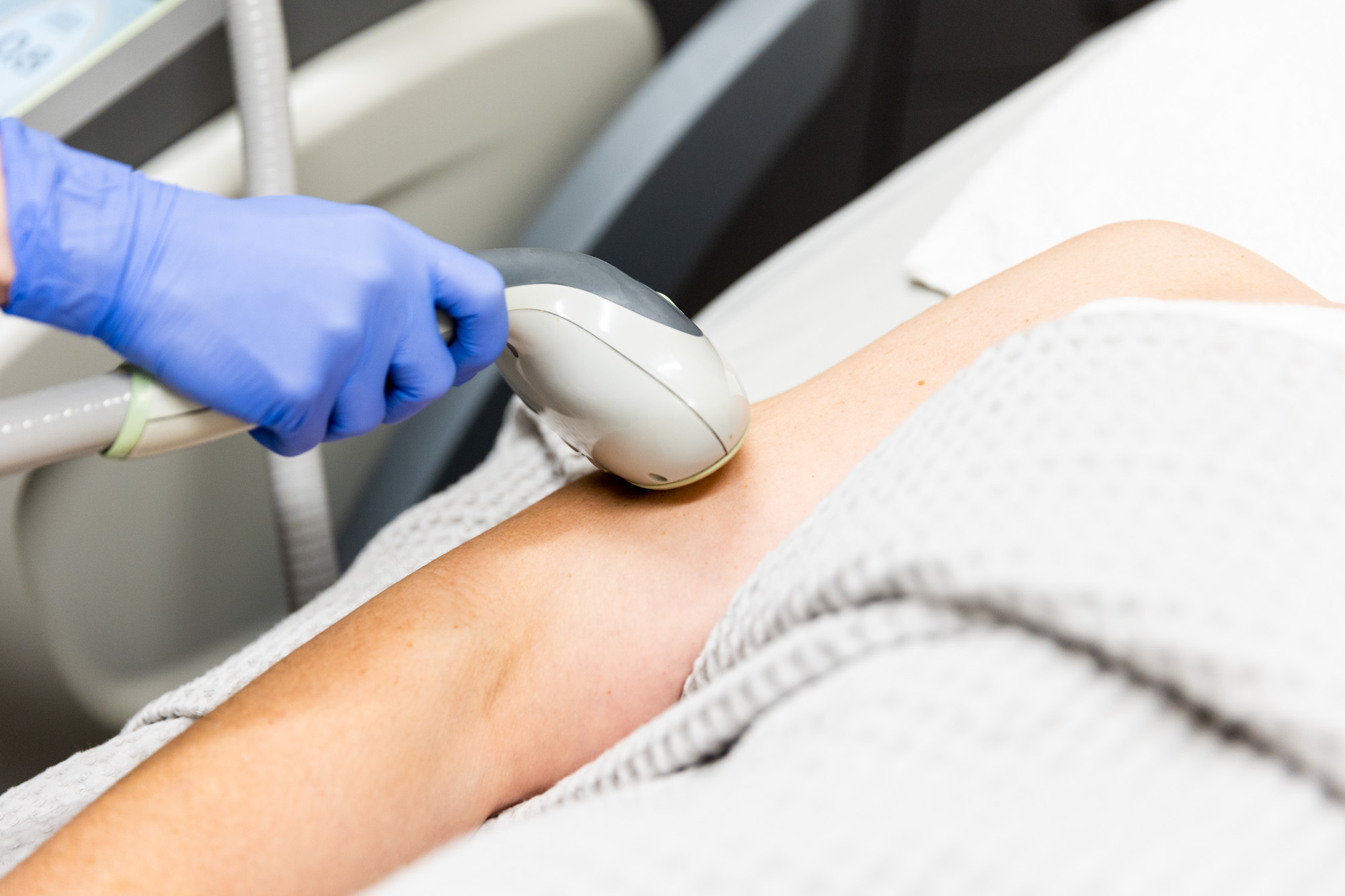 Close up shot of patient's arm. A medical professional's right hand is visible as they use the laser hair removal tool on the patient's upper arm.