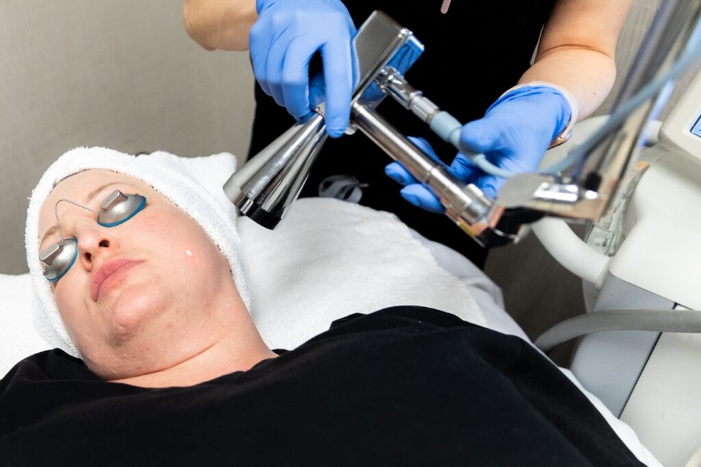 A female Kansas City Skin and Cancer Center provider uses the Micro Laser device to perform a Micro Laser Peel on a female client. Client is wearing protective eye coverings and has a towel covering her hair.