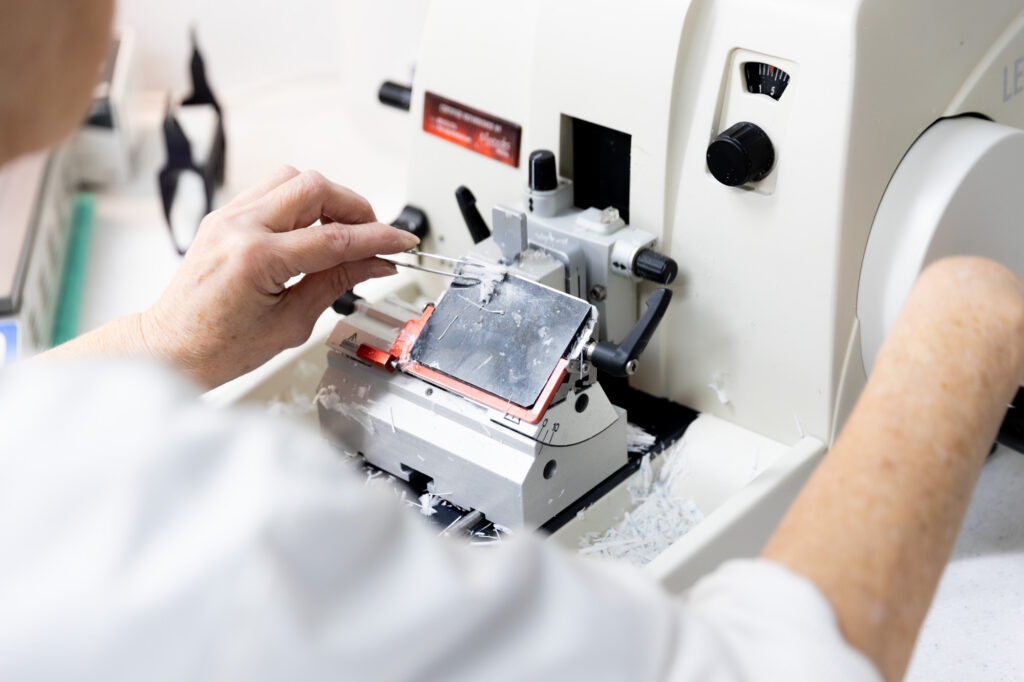 A provider performs a tissue cutting during a patient's skin cancer removal procedure in Kansas City, using a special device that allows them to see the different layers of the removed growth.