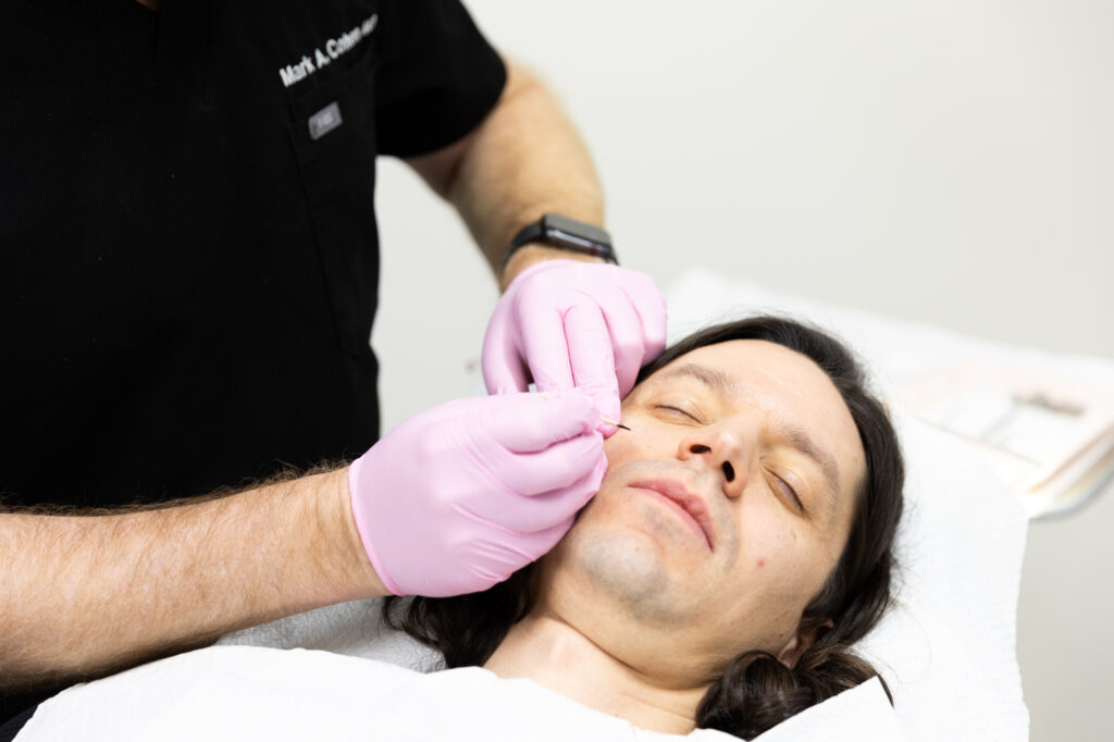 Dr. Mark Cohen uses a toothpick with a marker on it to mark skin cancer symptoms on the patient's cheek in Johnson County, KS. The patient is lying down on the medical exam table with their eyes closed.
