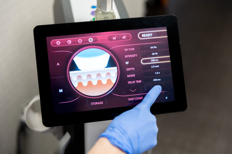 Gloved hand points at the "delay time" reading on the microneedling device. It reads 450 ms.