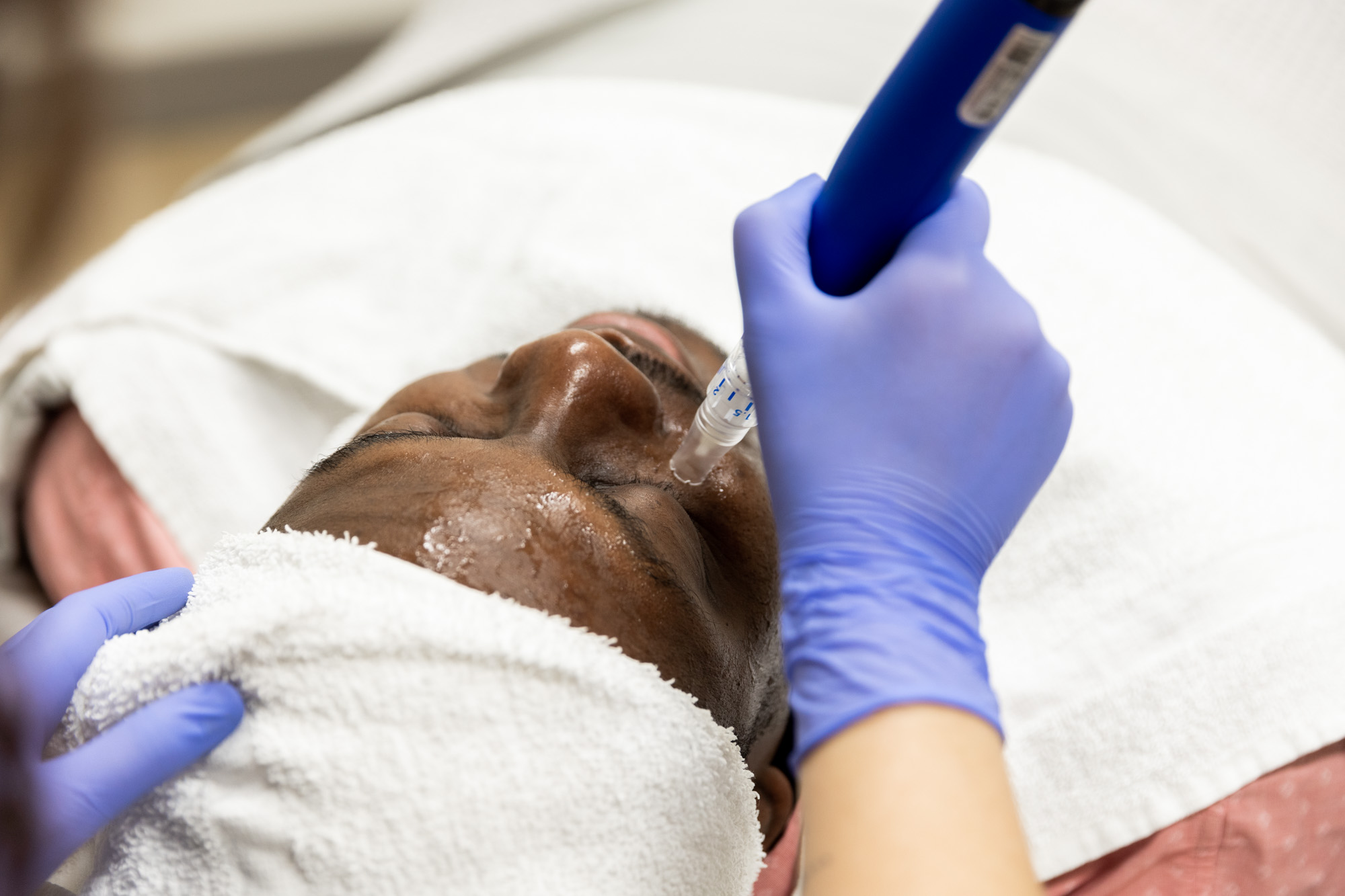 A medical professional holds up a pen-like applicator to a male patient's face during a facial.