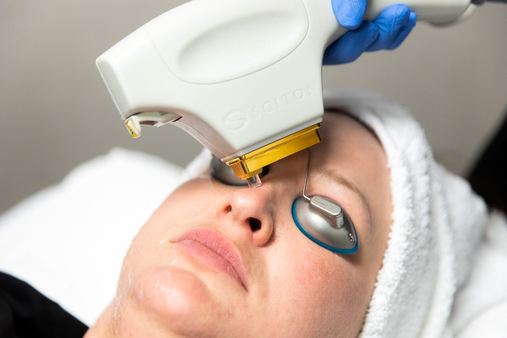 A woman is lying down with protective covers over her eyes to receive treatment for laser skin resurfacing in Kansas City.